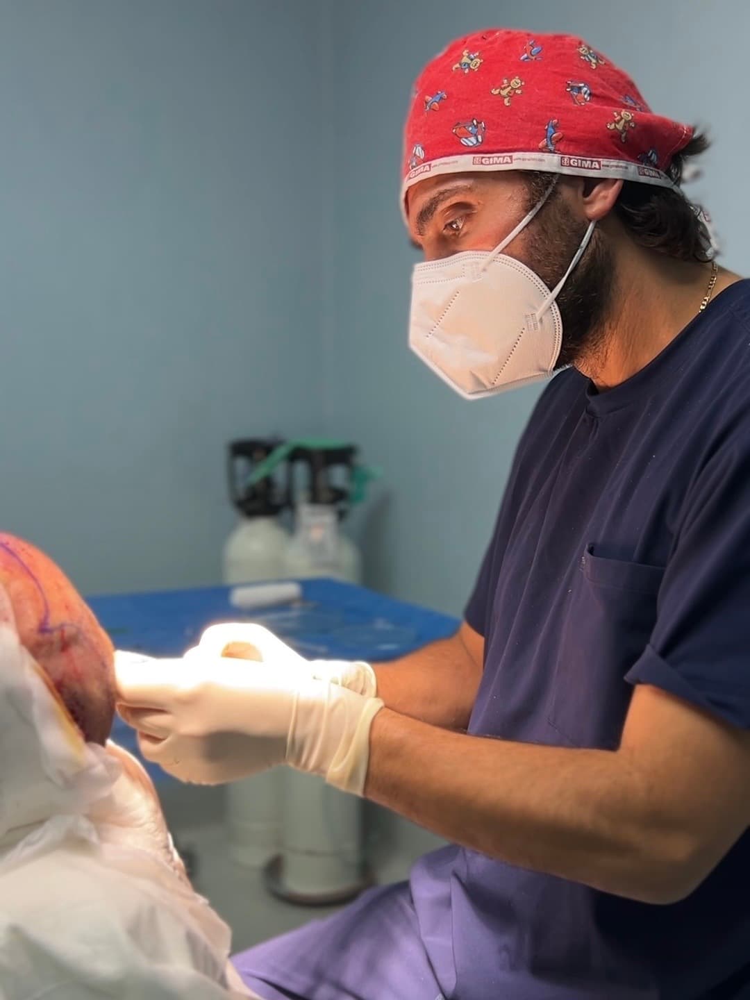 Specialised hair transplant team