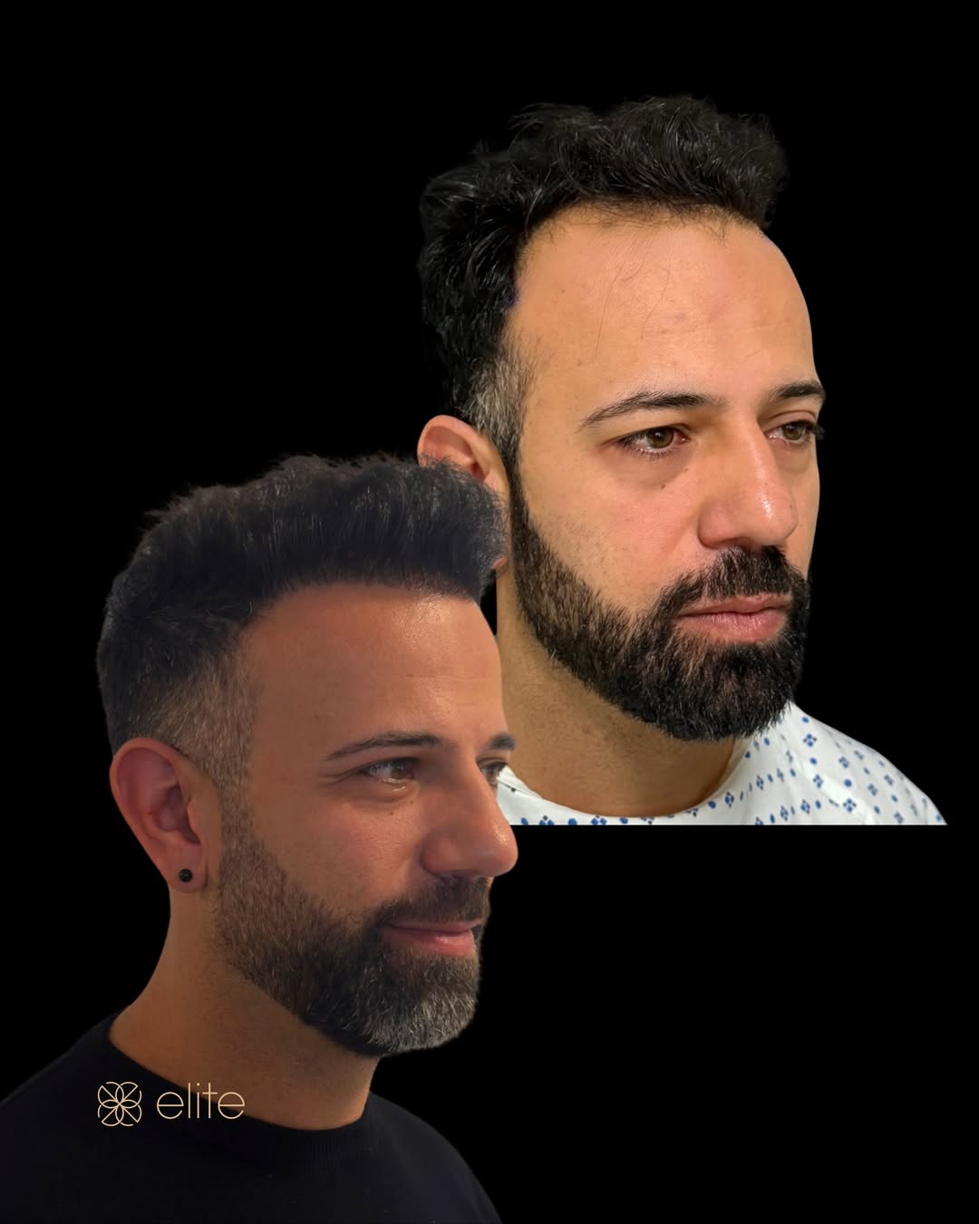Risultato (foto 10)